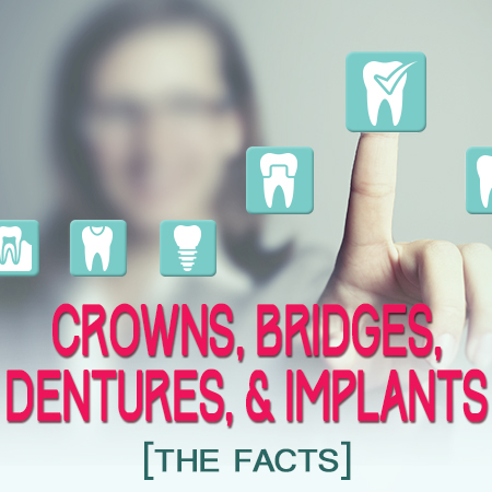 Crowns. Bridges, Dentures, & Implants: the fact