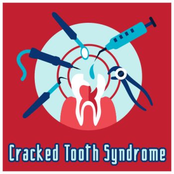 Watertown dentists, Dr. Will Buchholtz & Dr. Kyle Garro at Family Dental Practice discuss causes, symptoms, and treatment of cracked tooth syndrome.