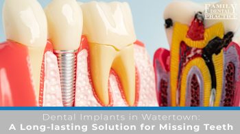 Learn how dental implants in Watertown, WI, offer a lasting, natural-looking solution for missing teeth. Discover the benefits and process with Family Dental Practice.