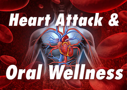 Heart attack & oral wellness