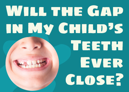 Watertown dentists Dr. Buchholtz & Dr. Garro of Family Dental Practice talk about potential causes and treatments for gapped teeth in children.