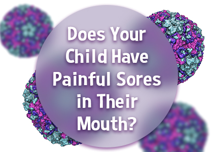 Watertown dentists, Dr. Buchholtz & Dr. Garro at Family Dental Practice tell parents about a common viral infection that may present with sores in your child’s mouth.