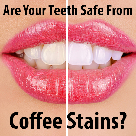 You don’t have to put up with discoloration and coffee stained teeth. Dr. Buchholtz & Dr. Garro at Family Dental Practice, tells you about teeth whitening in Watertown.