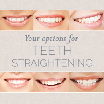 Watertown dentists, Dr. Will Buchholtz & Dr. Kyle Garro at Family Dental Practice share all you need to know about choosing the right teeth straightening option for you.