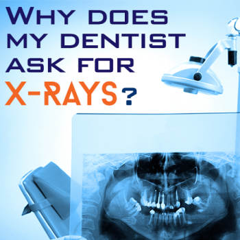 Watertown dentists, Dr. Buchholtz & Dr. Garro at Family Dental Practice, discuss the importance of dental x-rays for accurate diagnosis and treatment planning.