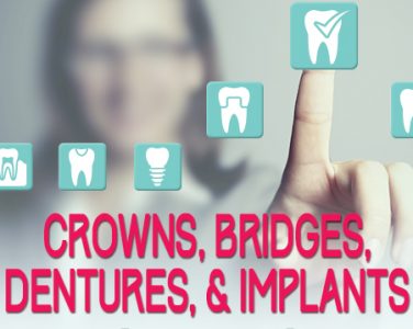 Crowns, Bridges, Dentures & Implants: The Facts - <p>There are lots of ways to deal with missing or damaged teeth. You’ve probably heard one of us at Family Dental Practice talking about implants, dentures, bridges, and crowns, but have you ever wondered what they are and how they work? Dr. Buchholtz and Dr. Garro knows that folks like to be informed, so think […]</p>
