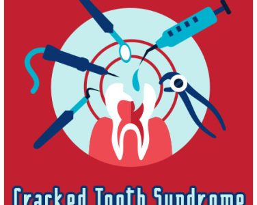 Crack Down on Cracked Tooth Syndrome - <p>Cracked tooth syndrome (CTS), also known as cracked cusp syndrome or split tooth syndrome, is a painful condition that results from a crack in one of your teeth. CTS can mean anything from a tiny hairline split in the crown to a fracture that goes all the way to the root.  If you have a […]</p>
