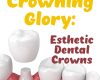 Crowning Glory: Esthetic Dental Crowns - April 27th, 2022