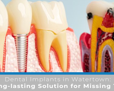 Dental Implants in Watertown: A Long-lasting Solution for Missing Teeth - <p>Restore Confidence with a Complete, Natural Smile Missing teeth don’t just affect how you look; they can impact your ability to eat, speak, and smile with confidence. Fortunately, there’s a long-lasting solution that looks, feels, and functions just like natural teeth: dental implants. At Family Dental Practice in Watertown, WI, we specialize in restoring smiles [&hellip;]</p>
