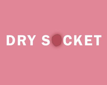 Can Dry Socket Be Deadly? - <p>The dreaded words of warning for anyone who has a tooth extraction: dry socket. A dry socket is a painful complication after a routine treatment like an extraction, but it can be avoided if you’re careful, and it definitely won’t kill you. Read more below from Watertown dentists, Dr. Buchholtz & Dr. Garro at Family […]</p>
