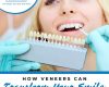 How Veneers Can Transform Your Smile - August 13th, 2025