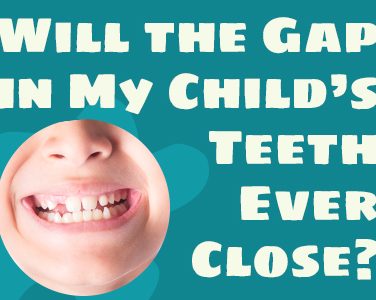 Will the Gap in My Child’s Teeth Ever Close? - <p>Diastema is the medical name for a space or gap between two teeth. While the most commonly gapped teeth are the two at upper front and center, a gap can occur between any two teeth. There are many potential causes for gapped teeth, including: Teeth that are too small for the jawbone Teeth that are […]</p>
