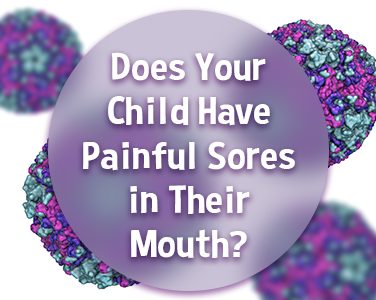 Does Your Child Have Painful Sores in Their Mouth? This Virus Could be the Cause - <p>You’ve probably heard the phrase, “Open mouth, insert foot” to describe a moment in which someone’s said something they wish they hadn’t, but have you heard of Hand, Foot, and Mouth Disease?  Despite it being a relatively common virus, it’s one that makes a lot of parents furrow their brow in confusion. Maybe the awareness […]</p>
