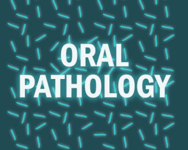Hot on the Trail with Oral Pathology - <p>When it comes to your oral health, we hope you never have any pains or problems. Good preventive care will help you always feel your best! But even with the best habits, dental problems do happen. In that case, oral pathology is the science and medicine that helps diagnose and treat whatever is making you […]</p>
