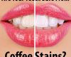 Are Your Teeth Safe from Coffee Stains? - September 27th, 2022