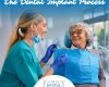 What to Expect During the Dental Implant Process - April 13th, 2025